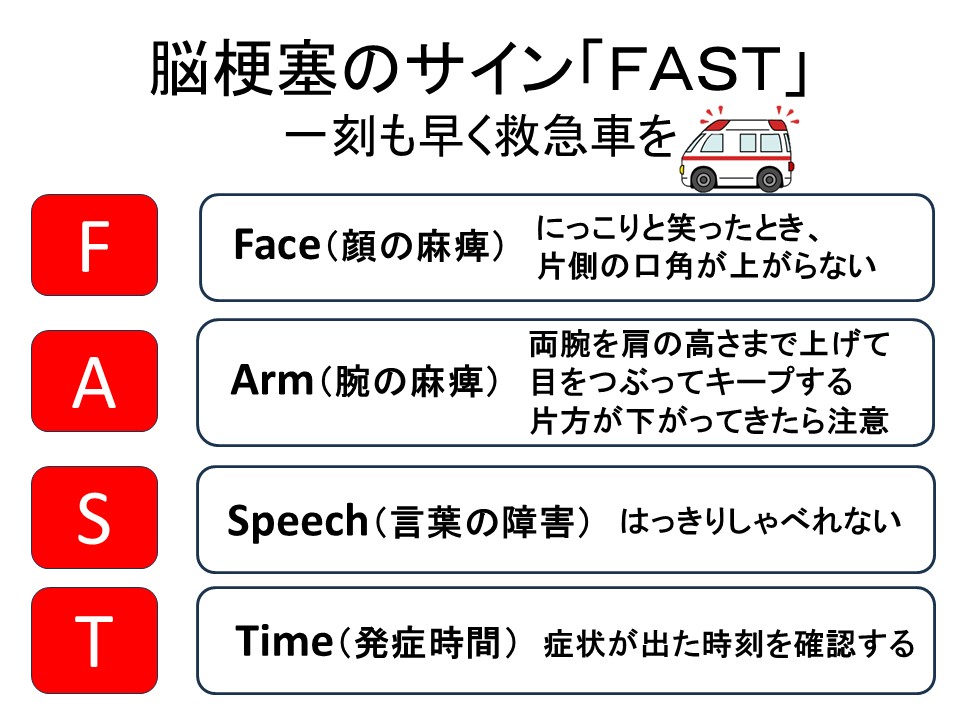 脳梗塞のサイン「FAST」