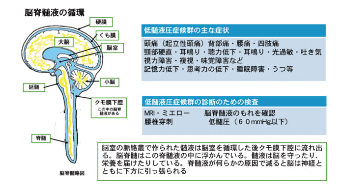 脳脊髄液の循環のイメージ図