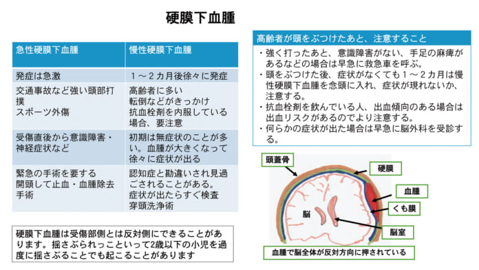 くも膜下出血の詳細とイメージ